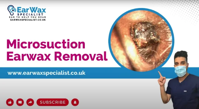 Microsuction Earwax Removal