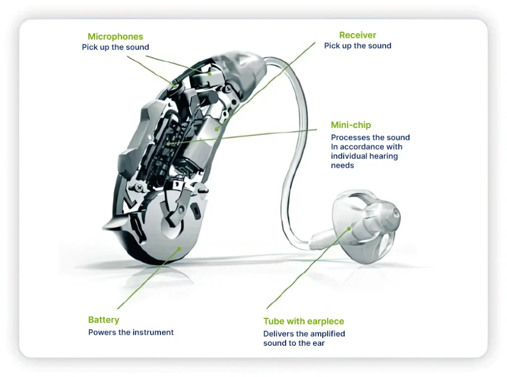 Behind-the-ear hearing aid with labeled parts including microphone, receiver, battery, and earpiece.