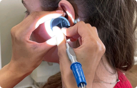 Patient receiving professional same-day ear wax removal treatment
